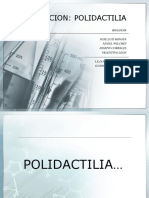 Polidactilia