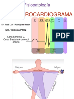 EKG