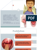 REFRESHING Carcinoma Tonsil