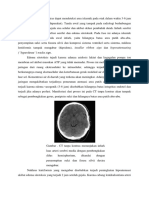 CT scan tanpa kontras dapat mendeteksi area iskemik pada otak dalam waktu 3.docx