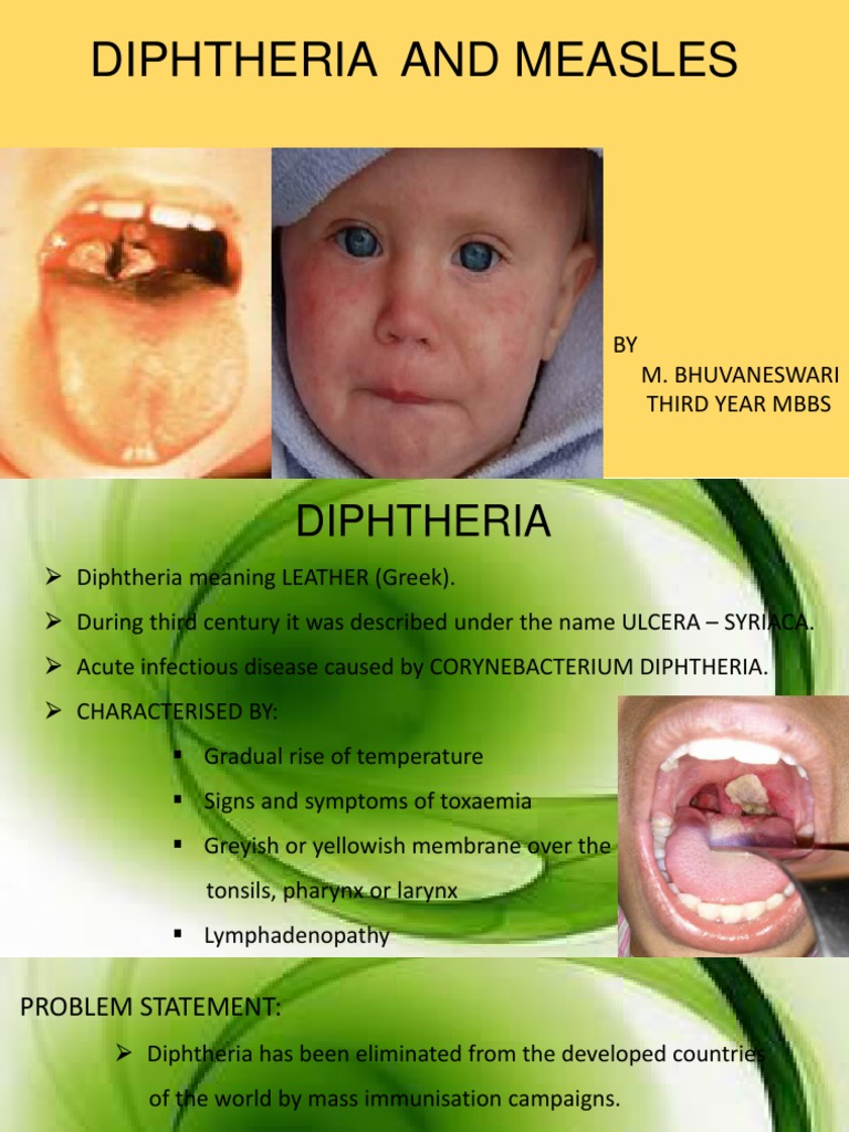 Diphtheria And Measles Measles Vaccines