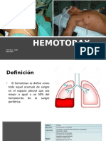 HEMOTORAX