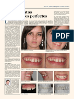 Tratamiento Provisionales Esteticos