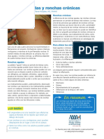 EL Hives Patent Spanish PDF