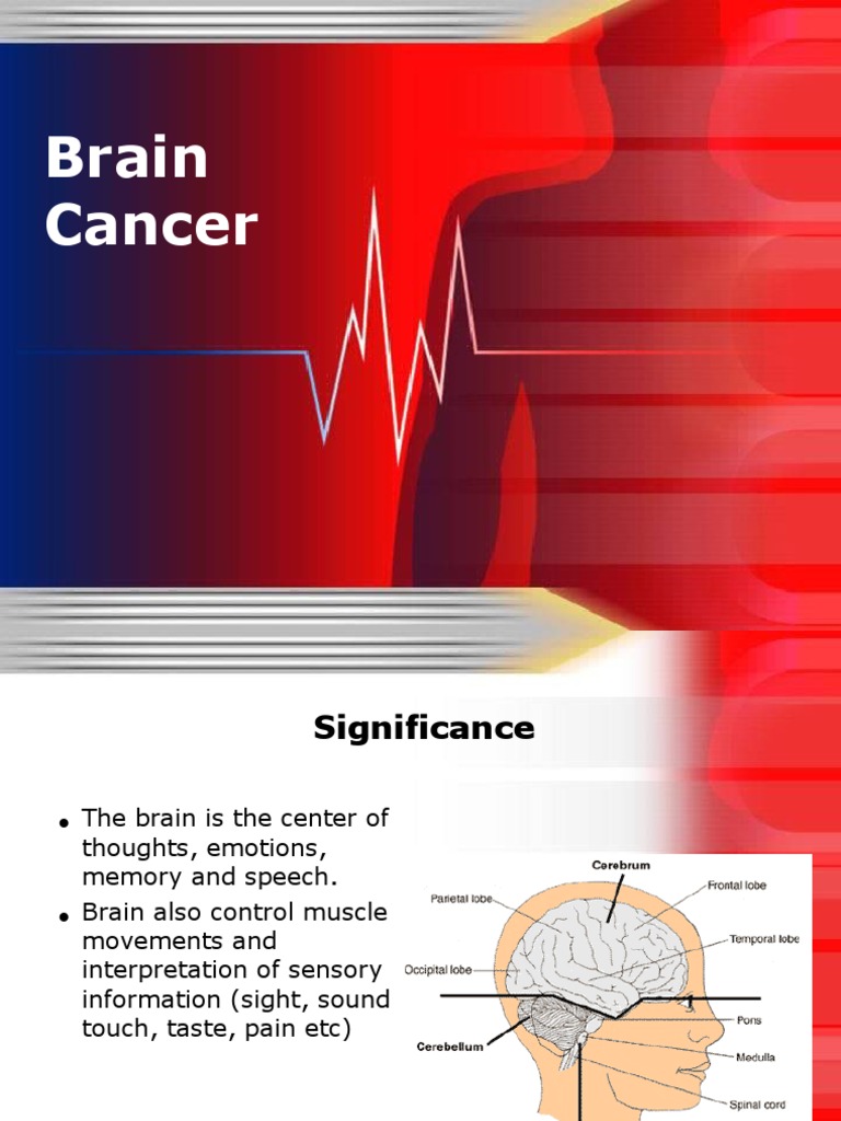 Brain Cancer | PDF | Radiation Therapy | Brain Tumor