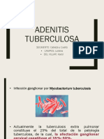 Adenitis Tuberculosa