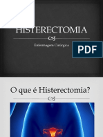 HISTERECTOMIA