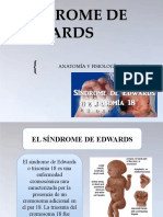 Síndrome de Edwards