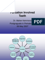 Furcation Involved Teeth (M.kemmona 07)