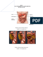 Laporan Pendahuluan Liposarcoma