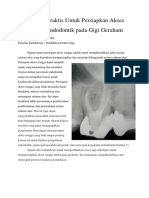 Panduan Praktis Untuk Persiapkan Akses Saluran Endodontik Pada Gigi Geraham (TUGAS MOS)