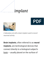 Brain Implant 