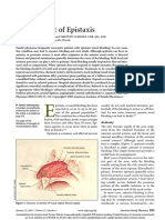 epistaxis aafp.pdf