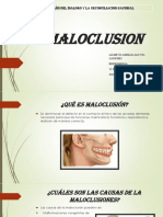 MALOCLUSION