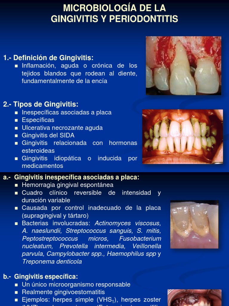 Microbiología de La Gingivitis y Periodontitis Inflamación