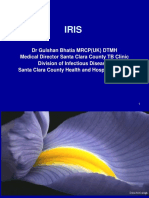 IRIS: Understanding Immune Reconstitution Inflammatory Syndrome