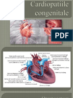 Cardiopatiile congenitale