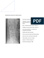 Tugas Radiologi Kelas Khusus Irma Yulianti C111 15 530