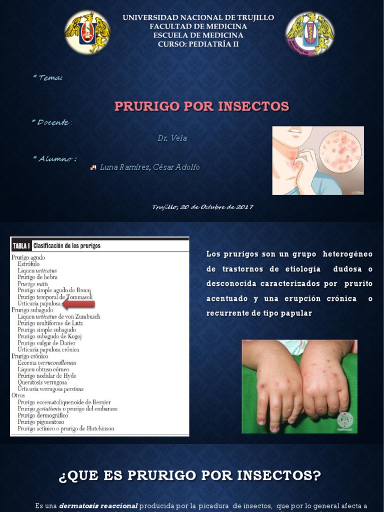 Prurigo Infantil por Picaduras de Insectos | PDF | Medicina | Inmunología