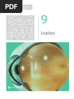 uveits medcel.pdf
