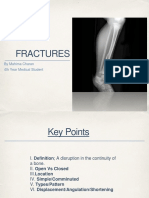 Fractures: by Mahima Charan 4th Year Medical Student