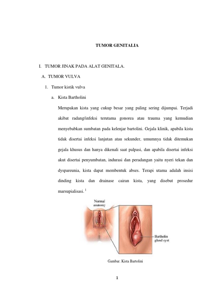 Qol eshak va qin fotosurati