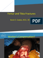 Kevin Coates MD Femur and Tibia Fractures