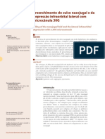 v4 Preenchimento Do Sulco Nasojugal e Da Depressao Infraorbital Lateral Com Microcanula 30G PDF