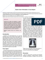 Peritonitis Following Prepyloric Ulcer Perforation A Case Report
