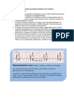 5 y 6 Hiprkalemia