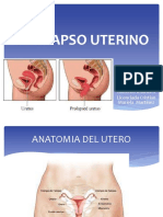 Prolapso Uterino