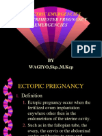 ECTOPIC PREGNANCY.ppt