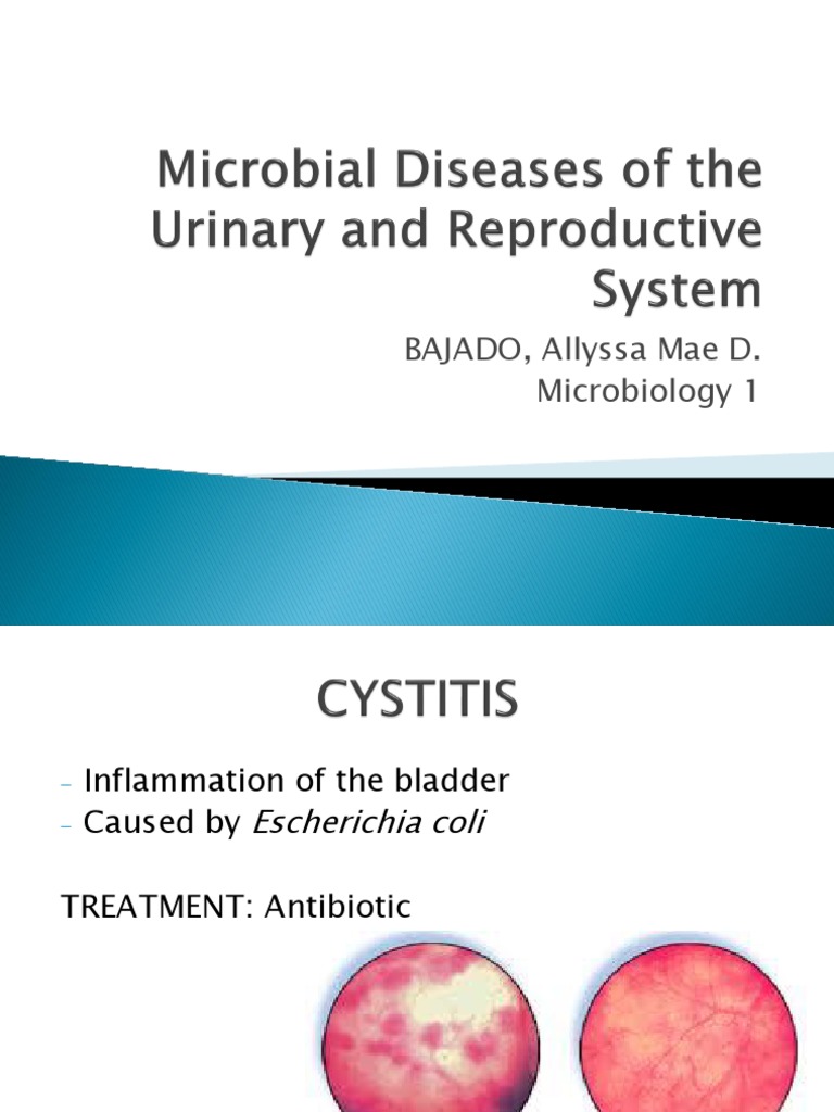 MicrobialDiseasesoftheUrinaryandReproductiveSystem.pptx Sexually Transmitted Infection