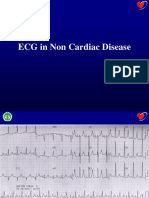 ECG in Non Cardiac Disease