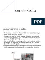 Cáncer de Recto 