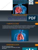 Tuberculosis