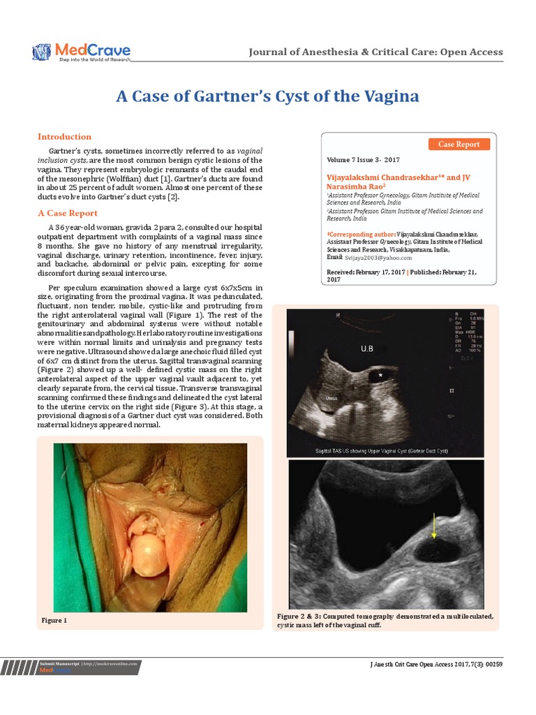 A Case Of Gartner S Cyst Of The Vagina Journal Of Anesthesia Critical Care Open Access Vagina Uterus