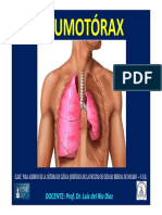 Neumotorax 121018042611 Phpapp01 PDF