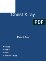 Chest X Ray Co Ass