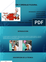 Punción y drenaje pleural guía