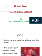 White Lesions Clinical Cases