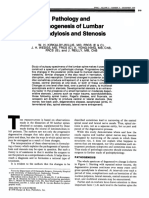 Lumbar Spondylosis