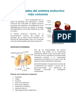 Enfermedades Del Sistema Endocrino Más Comunes