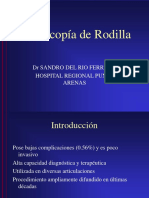 Artroscopía Rodilla