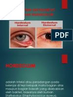 Hordeolum