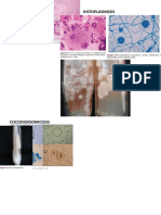 Histoplasmosis y Coccidioidomicosis
