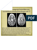 Gambar otak anak pada 1000 HPK.docx