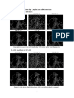 4.2 Edge Detection by Laplacian of Gaussian: A. LOG Method at NF 0.05