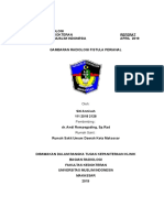 Referat Gambaran Radiologi Fsitula Perianal Annisah