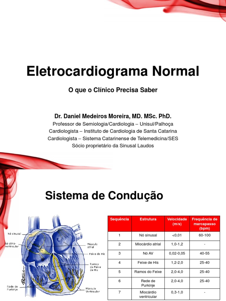 Eletrocardiograma: Guia Prático para Clínicos | PDF ...